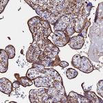 BASP1 Antibody in Immunohistochemistry (Paraffin) (IHC (P))