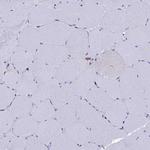 BASP1 Antibody in Immunohistochemistry (Paraffin) (IHC (P))