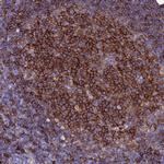 BASP1 Antibody in Immunohistochemistry (Paraffin) (IHC (P))