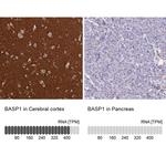 BASP1 Antibody in Immunohistochemistry (IHC)