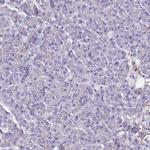 BASP1 Antibody in Immunohistochemistry (IHC)