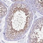 LDHC Antibody in Immunohistochemistry (Paraffin) (IHC (P))