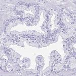 LDHC Antibody in Immunohistochemistry (IHC)