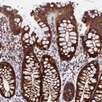 MRPS26 Antibody in Immunohistochemistry (Paraffin) (IHC (P))