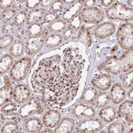 SIPA1L3 Antibody in Immunohistochemistry (Paraffin) (IHC (P))