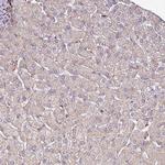 GPD2 Antibody in Immunohistochemistry (Paraffin) (IHC (P))