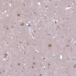 EFHA1 Antibody in Immunohistochemistry (Paraffin) (IHC (P))