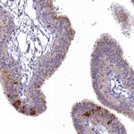 EFHA1 Antibody in Immunohistochemistry (Paraffin) (IHC (P))