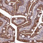 EFHA1 Antibody in Immunohistochemistry (Paraffin) (IHC (P))