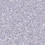 IL17REL Antibody in Immunohistochemistry (Paraffin) (IHC (P))