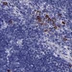 IL17REL Antibody in Immunohistochemistry (IHC)