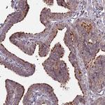 MINT3 Antibody in Immunohistochemistry (Paraffin) (IHC (P))