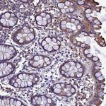 ZNF235 Antibody in Immunohistochemistry (Paraffin) (IHC (P))