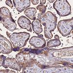 AP3M1 Antibody in Immunohistochemistry (Paraffin) (IHC (P))