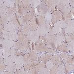 AP3M1 Antibody in Immunohistochemistry (Paraffin) (IHC (P))