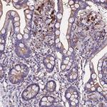 AP3M1 Antibody in Immunohistochemistry (Paraffin) (IHC (P))