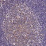 AP3M1 Antibody in Immunohistochemistry (Paraffin) (IHC (P))