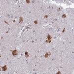 ELOF1 Antibody in Immunohistochemistry (Paraffin) (IHC (P))