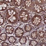 PPCDC Antibody in Immunohistochemistry (Paraffin) (IHC (P))