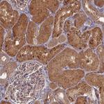 PPCDC Antibody in Immunohistochemistry (Paraffin) (IHC (P))