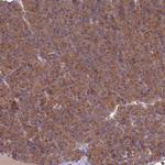 PPCDC Antibody in Immunohistochemistry (Paraffin) (IHC (P))