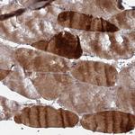 PPCDC Antibody in Immunohistochemistry (Paraffin) (IHC (P))