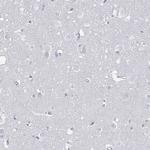 SSX1 Antibody in Immunohistochemistry (Paraffin) (IHC (P))