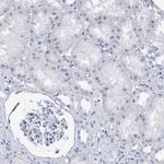 SSX1 Antibody in Immunohistochemistry (Paraffin) (IHC (P))