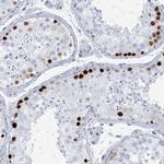 SSX1 Antibody in Immunohistochemistry (Paraffin) (IHC (P))