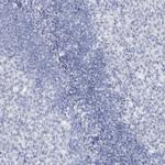 SSX1 Antibody in Immunohistochemistry (Paraffin) (IHC (P))