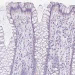 HAPLN2 Antibody in Immunohistochemistry (Paraffin) (IHC (P))