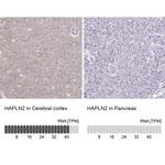 HAPLN2 Antibody in Immunohistochemistry (IHC)