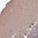 UTP11L Antibody in Immunohistochemistry (Paraffin) (IHC (P))