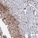 PNRC2 Antibody in Immunohistochemistry (Paraffin) (IHC (P))