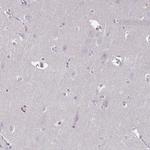 Desmoplakin Antibody in Immunohistochemistry (Paraffin) (IHC (P))