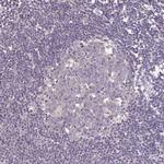 Desmoplakin Antibody in Immunohistochemistry (Paraffin) (IHC (P))