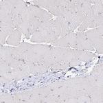 Desmoplakin Antibody in Immunohistochemistry (IHC)