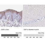 Desmoplakin Antibody