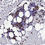 MCM10 Antibody in Immunohistochemistry (Paraffin) (IHC (P))