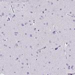 MCM10 Antibody in Immunohistochemistry (Paraffin) (IHC (P))