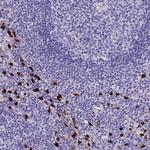 MCM10 Antibody in Immunohistochemistry (Paraffin) (IHC (P))