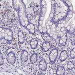 MCM10 Antibody in Immunohistochemistry (Paraffin) (IHC (P))