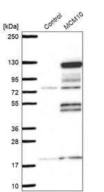 MCM10 Antibody in Western Blot (WB)