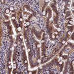 NSUN6 Antibody in Immunohistochemistry (Paraffin) (IHC (P))