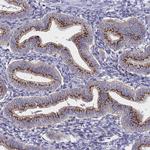 NSUN6 Antibody in Immunohistochemistry (Paraffin) (IHC (P))