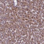 NSUN6 Antibody in Immunohistochemistry (Paraffin) (IHC (P))