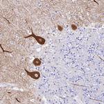 NKB Antibody in Immunohistochemistry (Paraffin) (IHC (P))