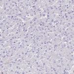 NKB Antibody in Immunohistochemistry (Paraffin) (IHC (P))