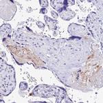 NKB Antibody in Immunohistochemistry (Paraffin) (IHC (P))