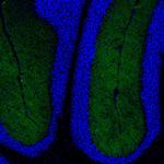 NKB Antibody in Immunohistochemistry (Paraffin) (IHC (P))